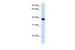 FOXE1 Rabbit anti-Human, Polyclonal, Novus Biologicals 0.1 mL | Buy Online | Novus Biologicals | Fisher Scientific
